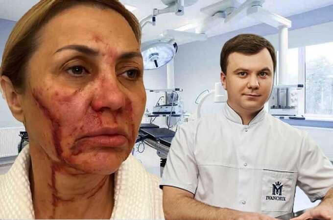 “Elite surgeon” with a fake reputation: who is Maxim Ivanchuk, the man who disfigured Victoria Bonya’s mother?